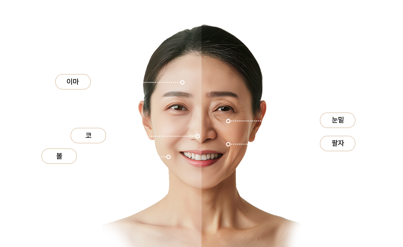 필터 시술 부위