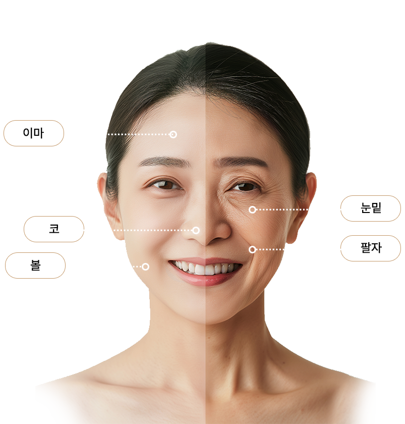 필터 시술 부위