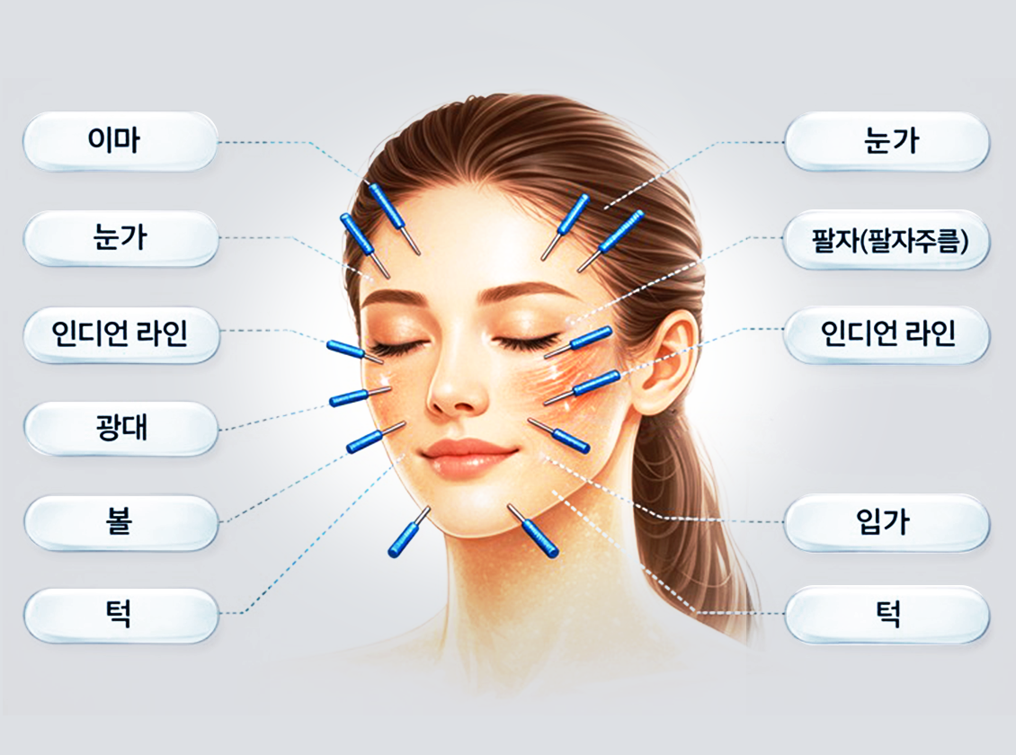 동안침 주요 시술부위