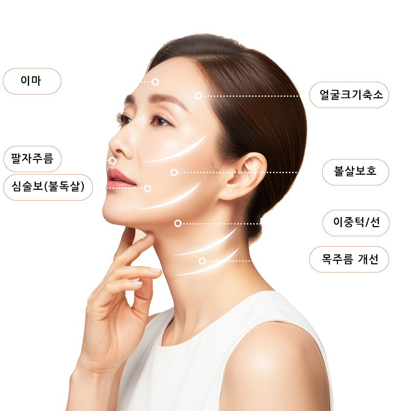 울쎄라 시술 부위