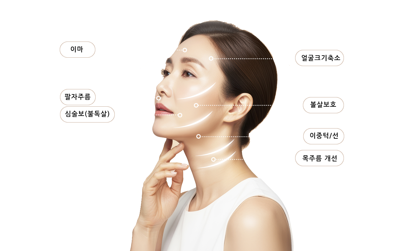 울쎄라 시술 부위